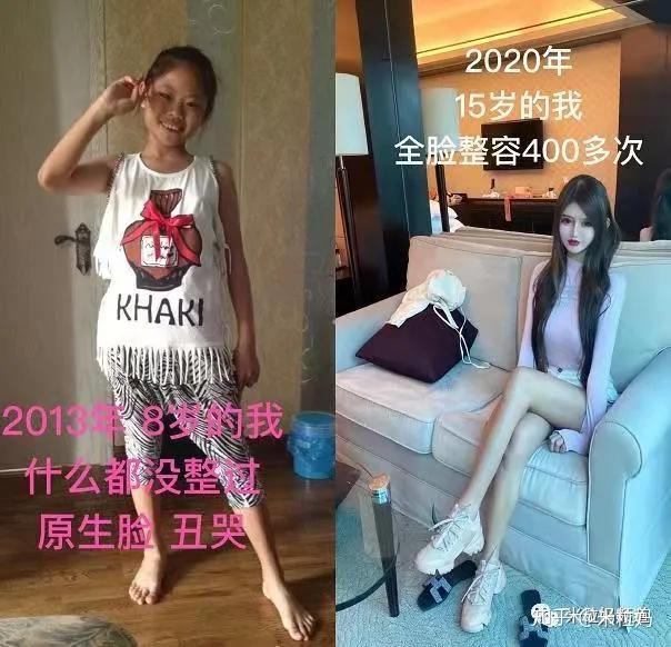 看看小z娜娜整容前的照片,我没觉得需要这么大动干戈,女娲再造的.