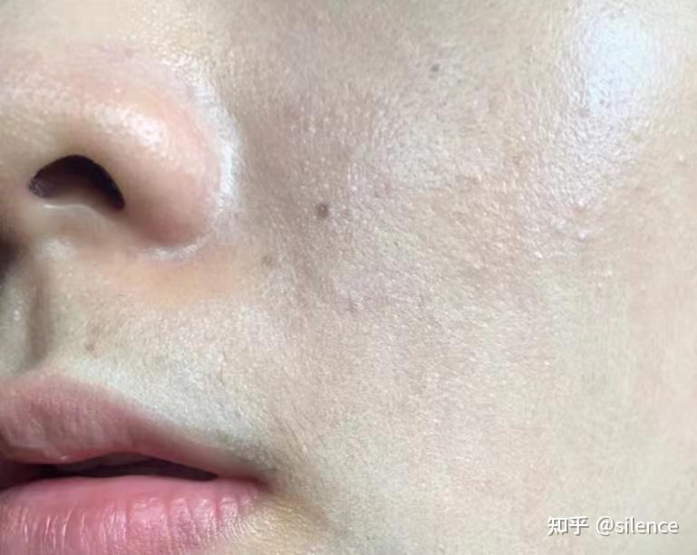 天天化妆卡粉求推荐性价比高的补水面膜