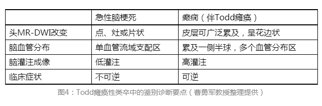 至于todd瘫痪性类卒中的鉴别诊断要点,曹勇军教授归纳如下(图4).