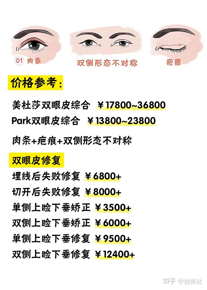 双眼皮手术价格表