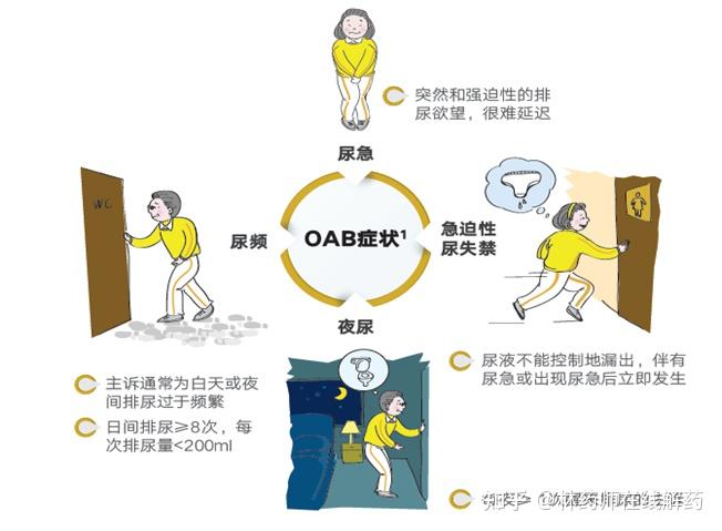 膀胱過度活動症,簡稱oab,是以尿急為核心症狀的一組症候群,常伴有尿頻