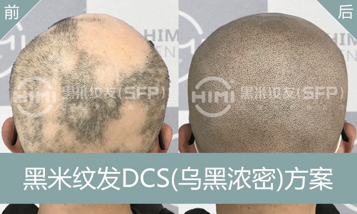纹发效果真那么好嘛？一文读懂SMP纹发的真相 - 知乎