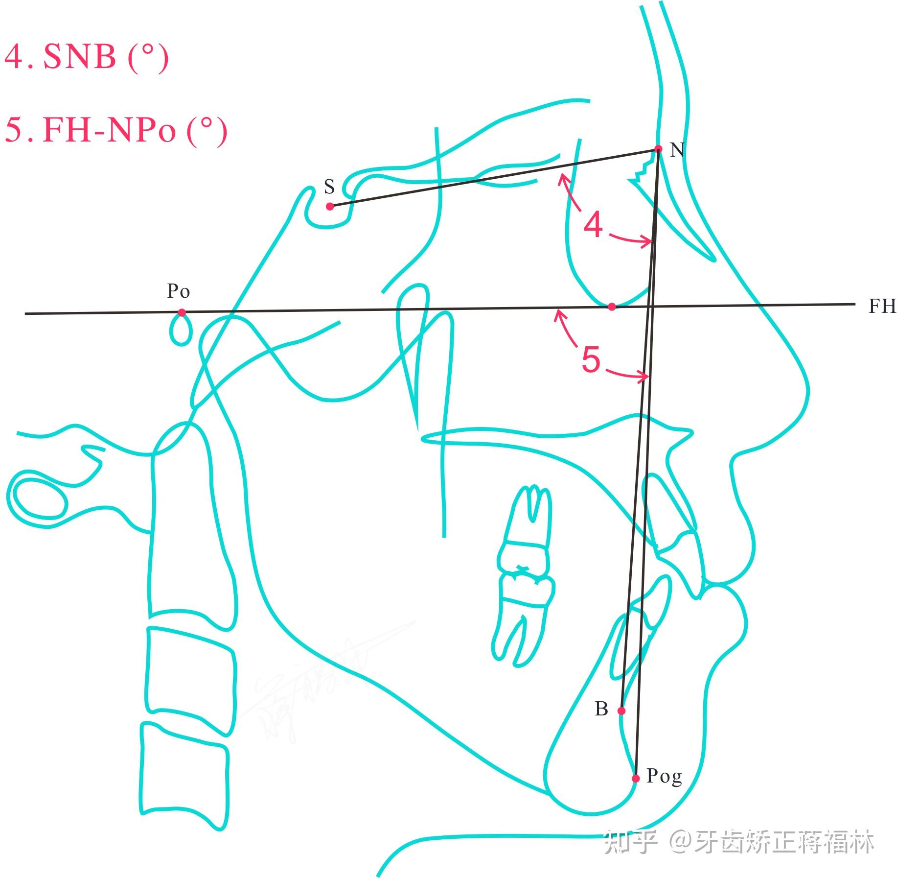 头影测量——上海九院分析法