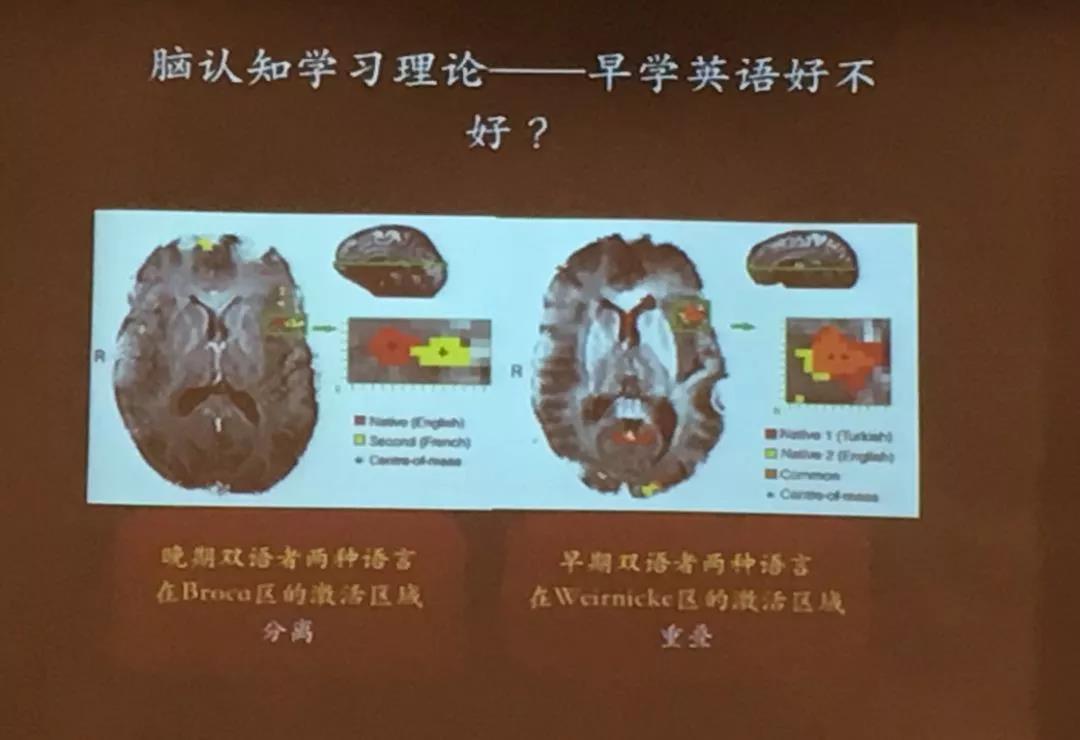 通过对早期和晚期双语者大脑的断层扫描,科学家发现早期双语者的大脑