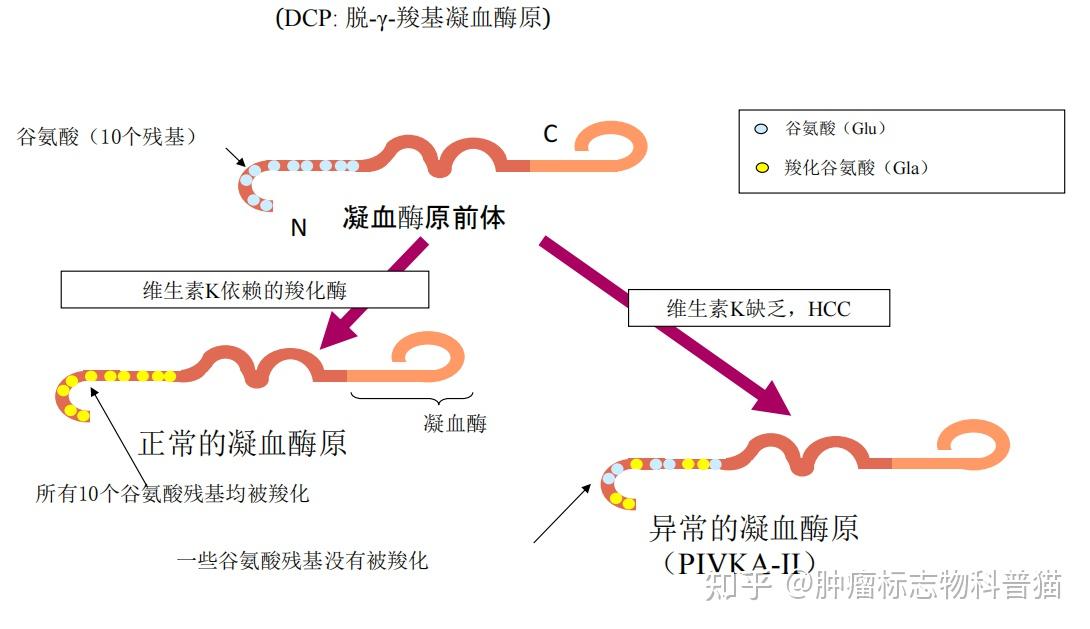 肝癌筛查新指标:异常凝血酶原(pivka-ii)