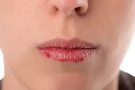 涂唇膏一天不应超过几次 6招教你防治嘴唇干裂 知乎 涂唇膏一天不应超过几次 6招教你防治嘴唇干裂 知乎