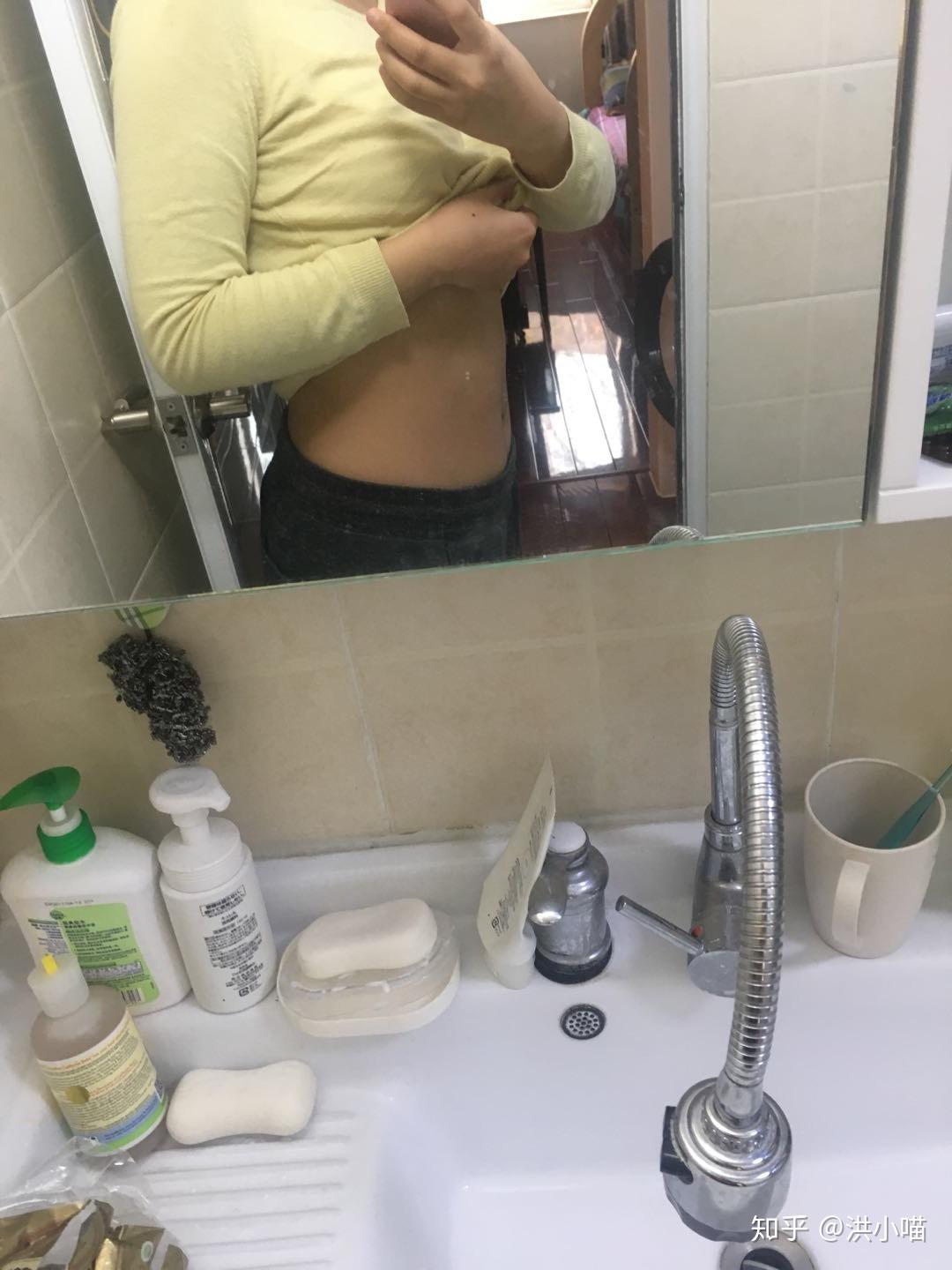 女人生完孩子后肚子的真实状态是怎样的