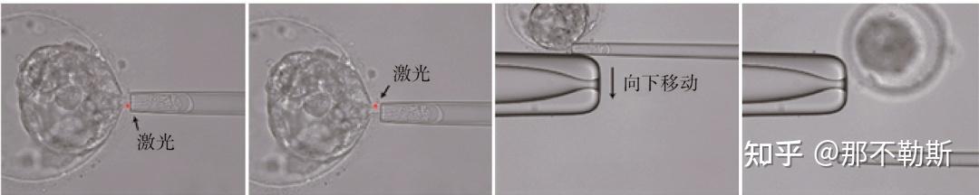 囊胚滋养层细胞活检技术的优势及操作解析 - 知乎