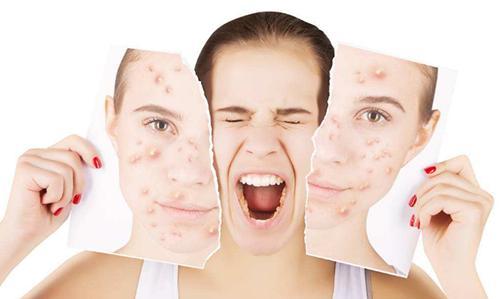 怎么护肤才是正确 v2-0b863e8dd7429515bfdd7a6a90fe400f_1440w.jpg?source=172ae18b