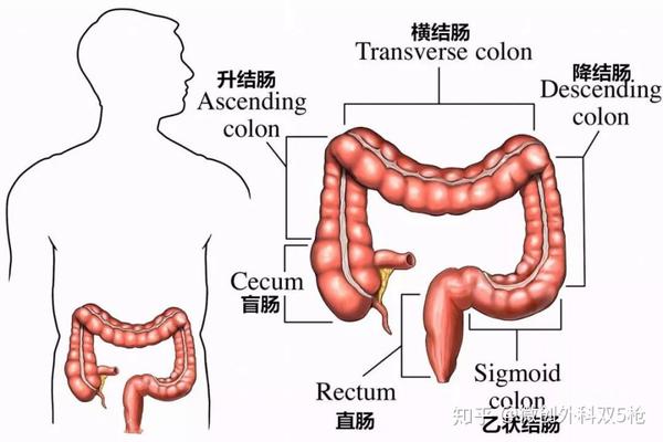 乙状结肠疼痛位置图片图片