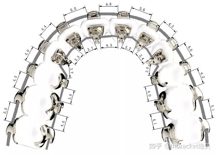 你身边有做舌侧矫正的朋友吗