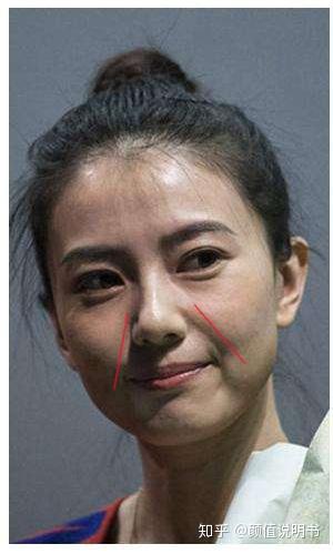 长得不丑 笑起来难看怎么治?