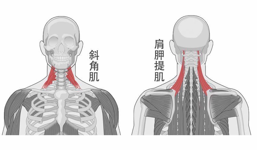 引起椎关节失稳,与椎关节连接的肌肉就会遭殃,如引起颈椎侧面疼痛的