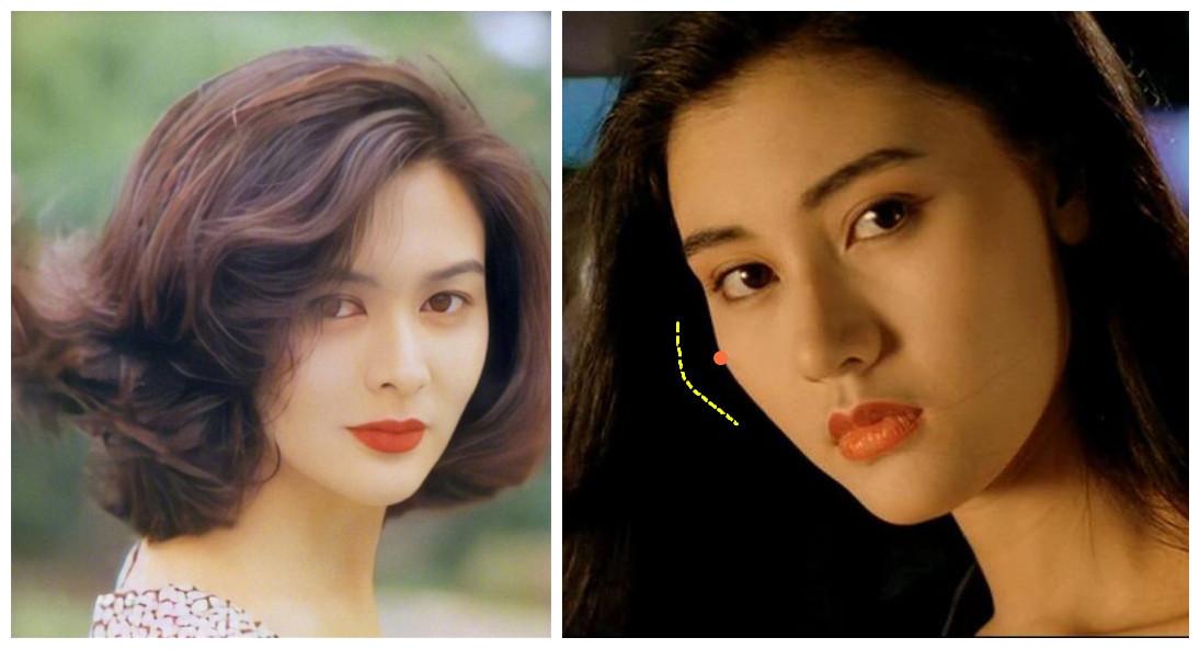 颧骨是骨相美的关键范芳医生谈颧部之美