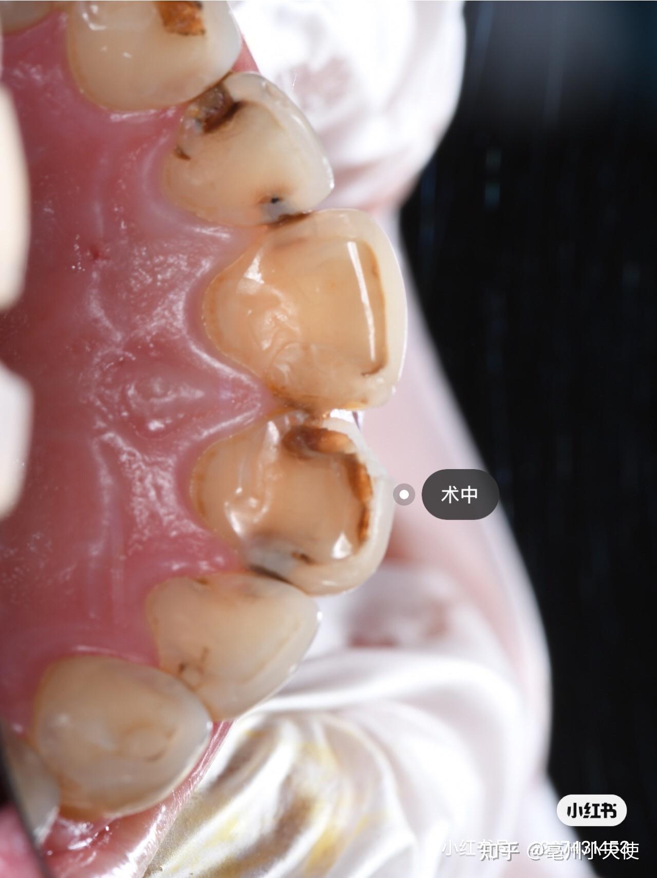 断牙日志 - 知乎