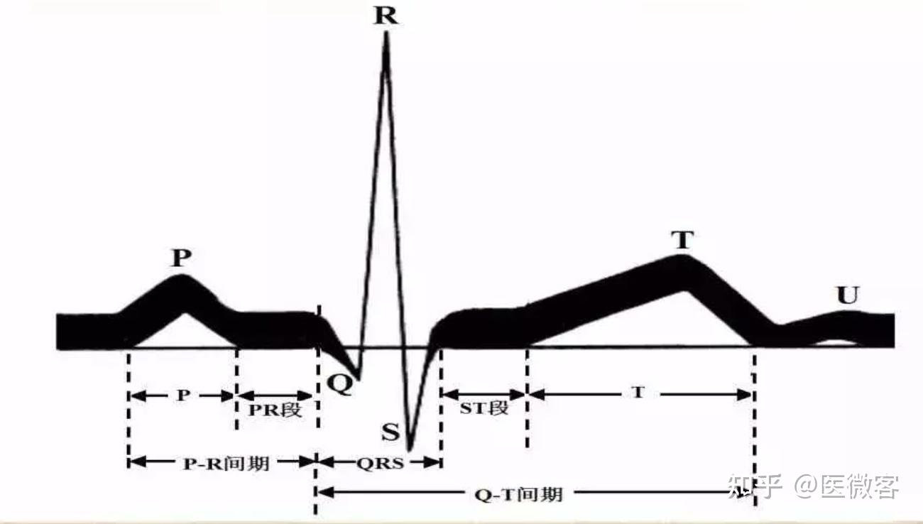 零基础秒懂这样看心电图一学就会