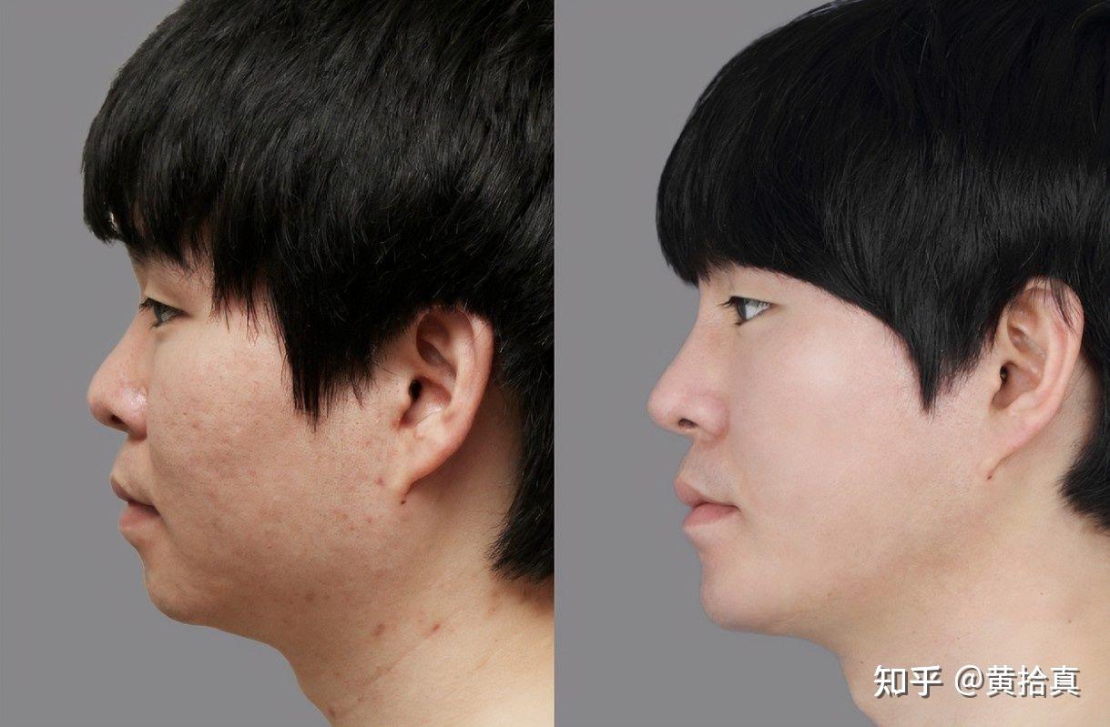 【福岡の男性美容整形】二重整形・鼻整形・美肌治療｜美容整形･美容外科の福岡TAクリニック