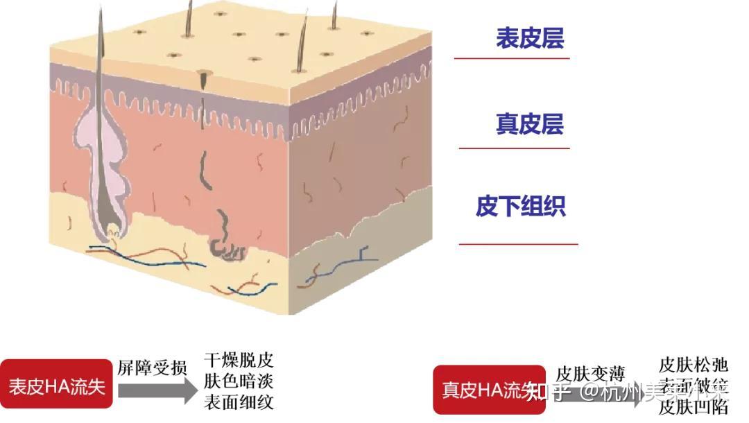 人们就将目光放到了皮肤更深一层—真皮层,也就是我们所指的中胚层