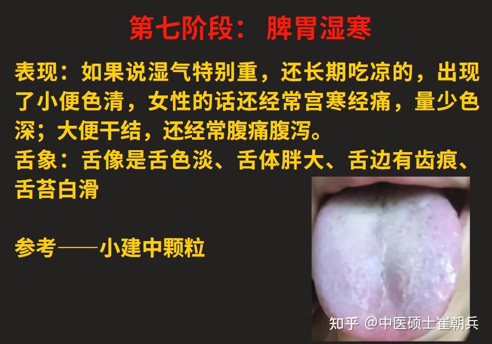 脾气虚、脾阳虚,由轻到重,看看自己的脾虚在哪个阶段?12个阶段的脾虚一次讲明白 - 知乎