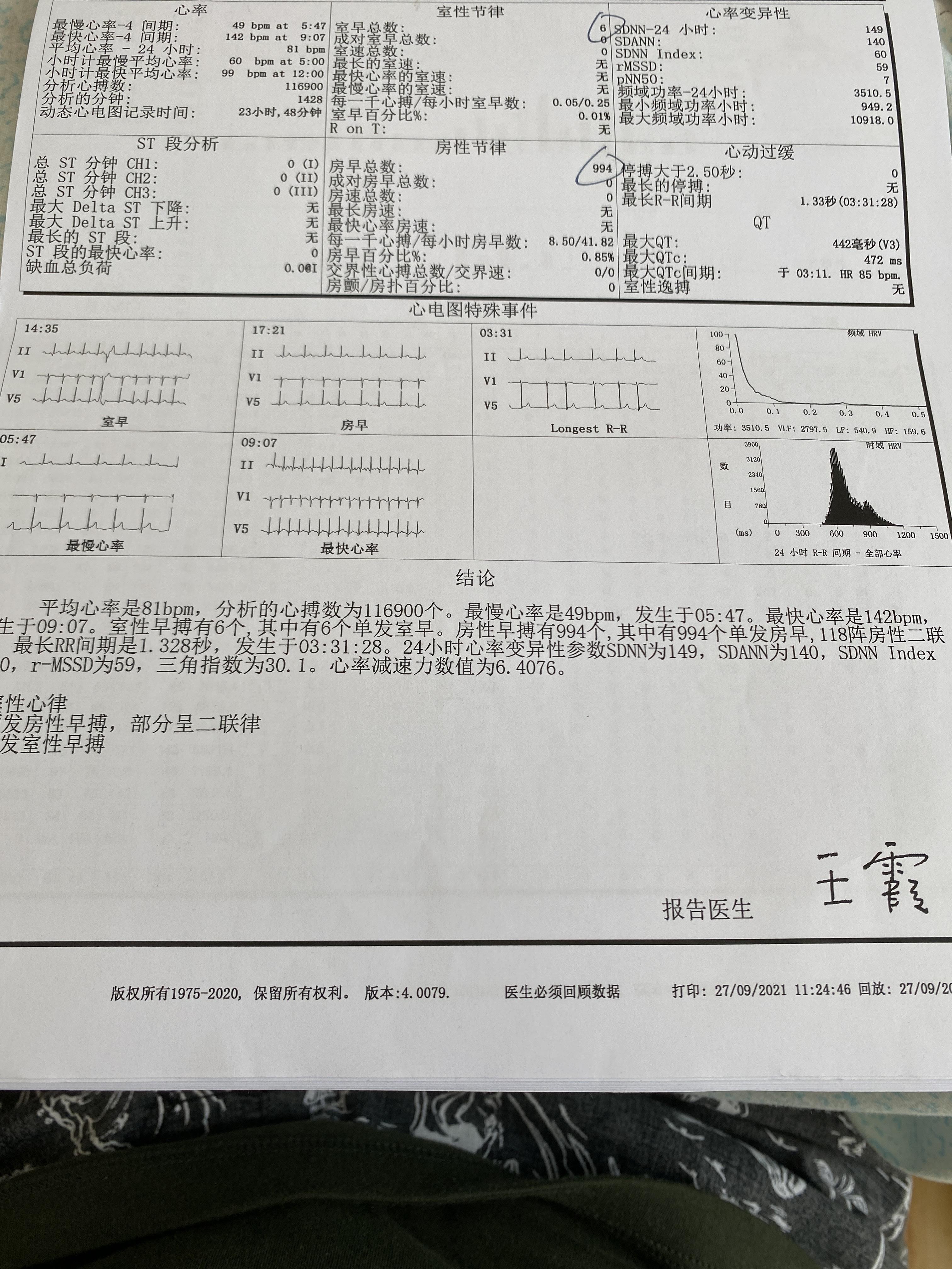 一个心脏瓣膜修复患者的自述