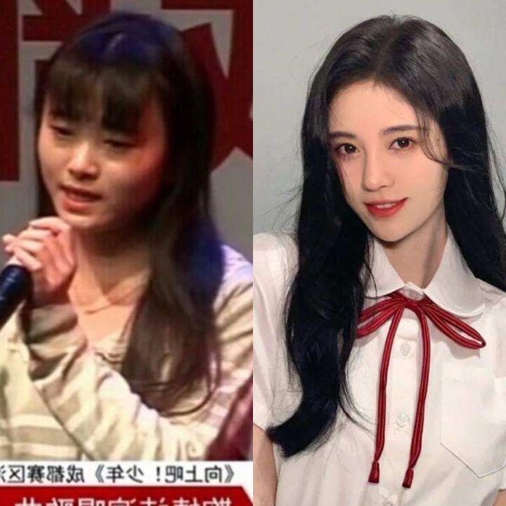 鞠婧祎超全整形818分析 从头皮do到脚 不愧是整形界教科书 知乎 鞠婧祎超全整形818分析 从头皮do到脚 不愧是整形界教科书 知乎
