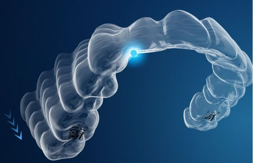 时代天使是国产还是进口的?时代天使标准版多少钱(内附价格表) - 知乎
