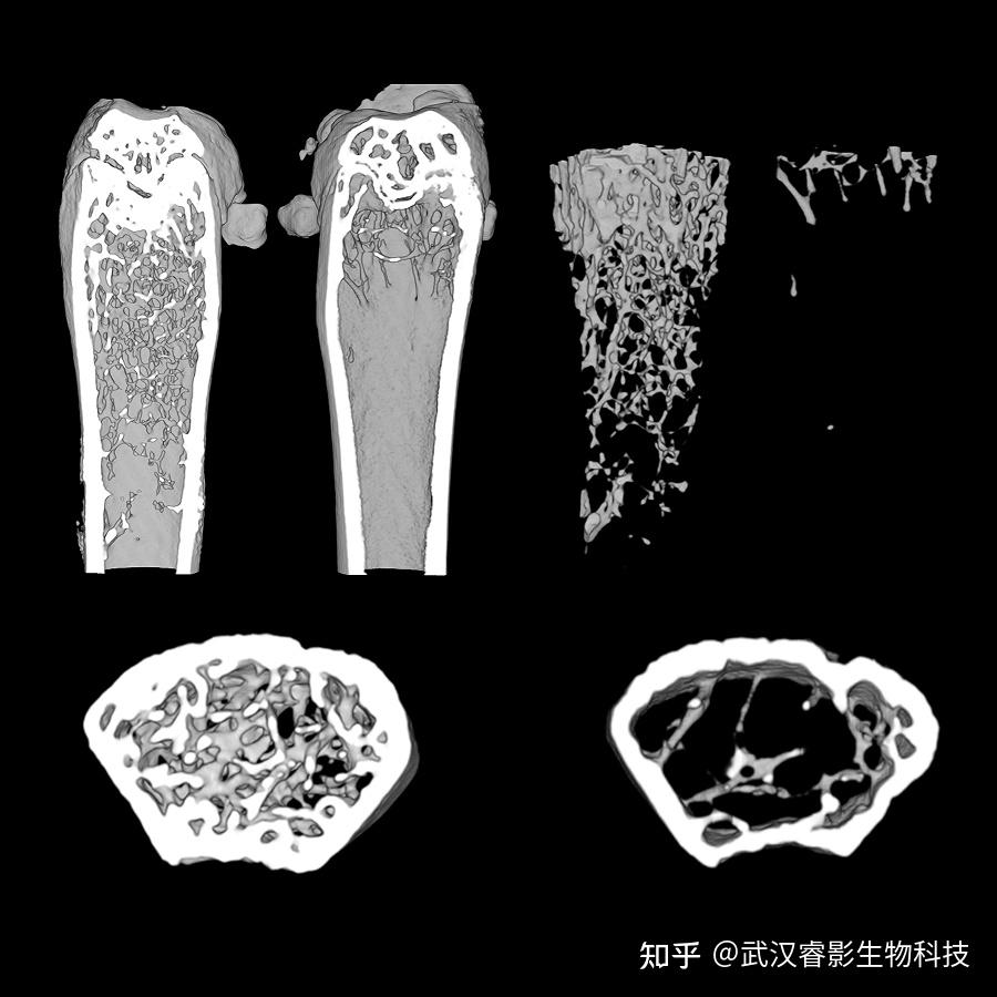 硬组织与肺部结构的“透视眼”:Micro CT - 知乎
