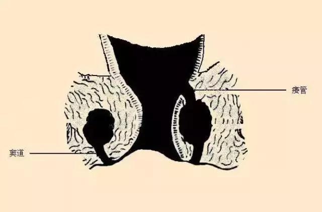 了该文章 对于肛周脓肿疾病认识浅薄的人,肛周脓肿中医称之为"肛痈"