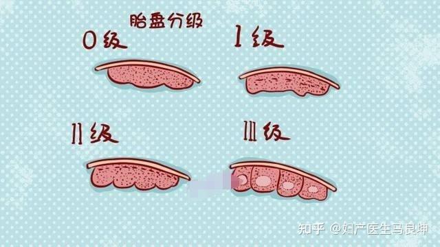 B超显示胎儿比实际孕期大一周,会提前生吗?关键看这四个因素! - 知乎