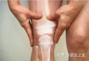 前交叉韧带和后交叉韧带那些区别 知乎
