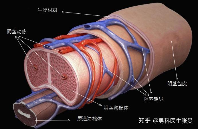 阴痉静脉纤维化图片