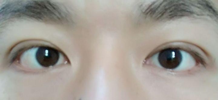 怎样让近视多年的无神眼睛恢复神采? - 知乎