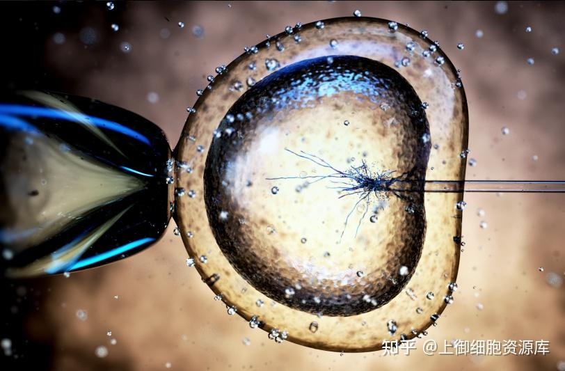 逆转损伤干细胞修复脑损伤真实案例