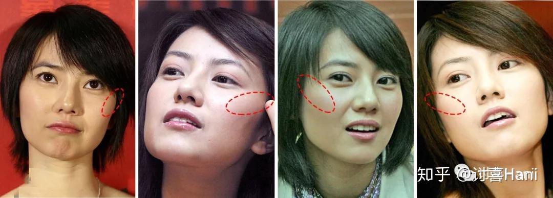 总结了10种大脸脸大自救指南拿好不谢
