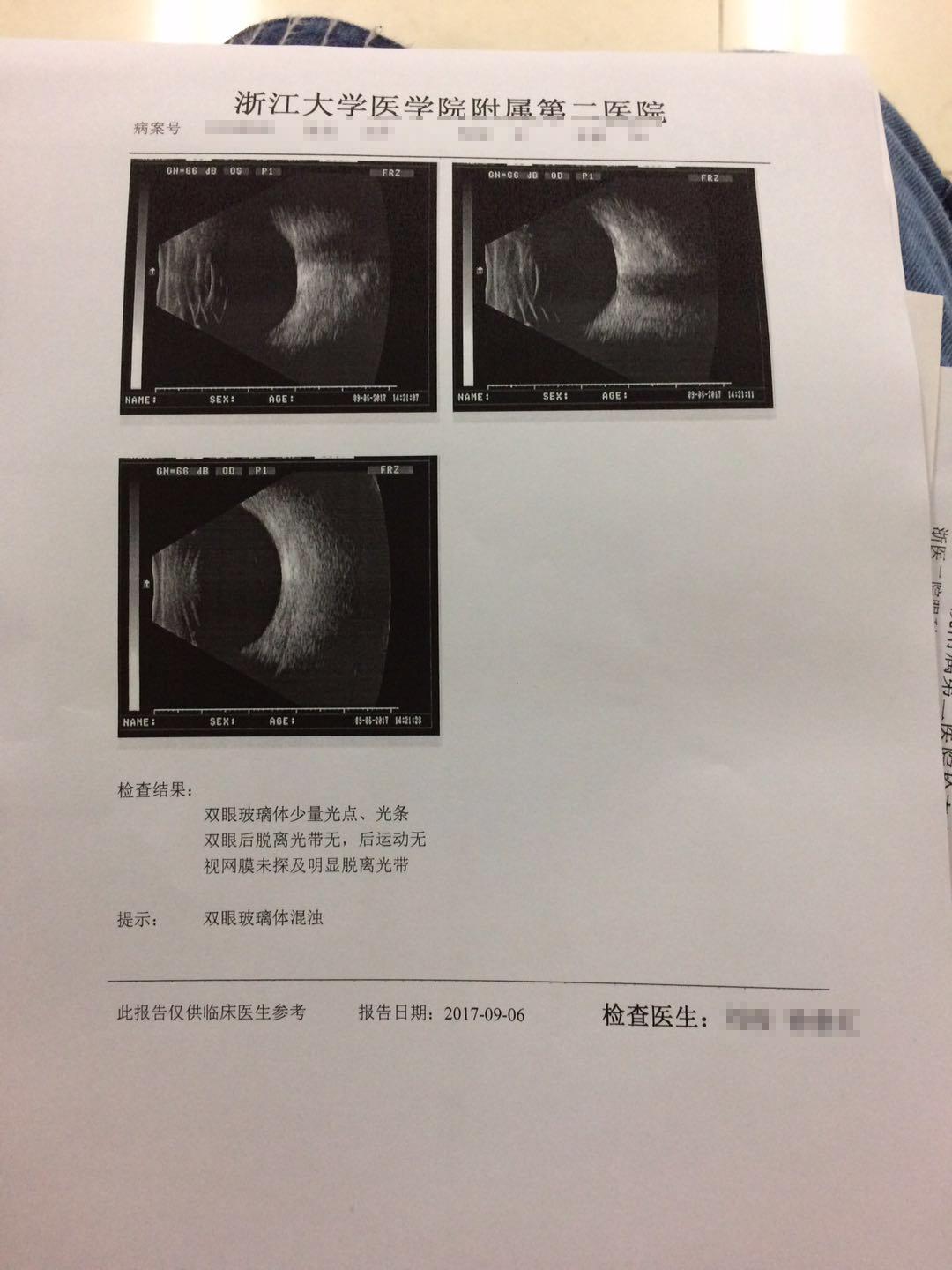 什么地形图,眼压,眼干(检查报告上说我处于临界值)角膜厚度(510,512)