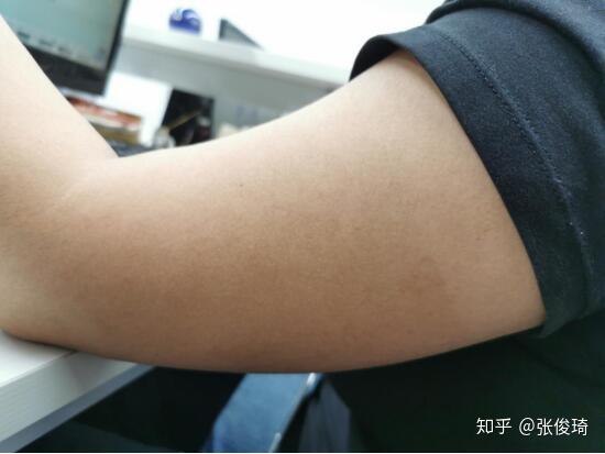 遗传鸡皮肤怎么哄女朋友(为什么鸡皮肤一定会遗传给女孩子)