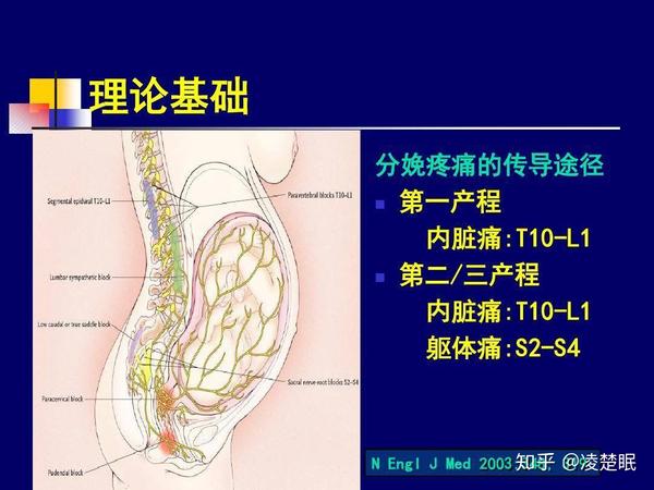 关于分娩镇痛的一切，看这篇文章就够了 知乎