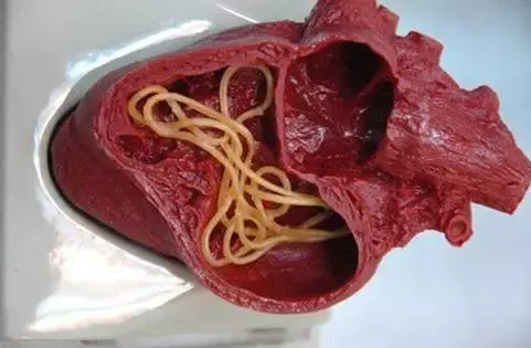 循环系统寄生虫病: 犬心丝虫病 ,犬巴贝西焦虫病蜱虫:蜱在叮刺吸血时