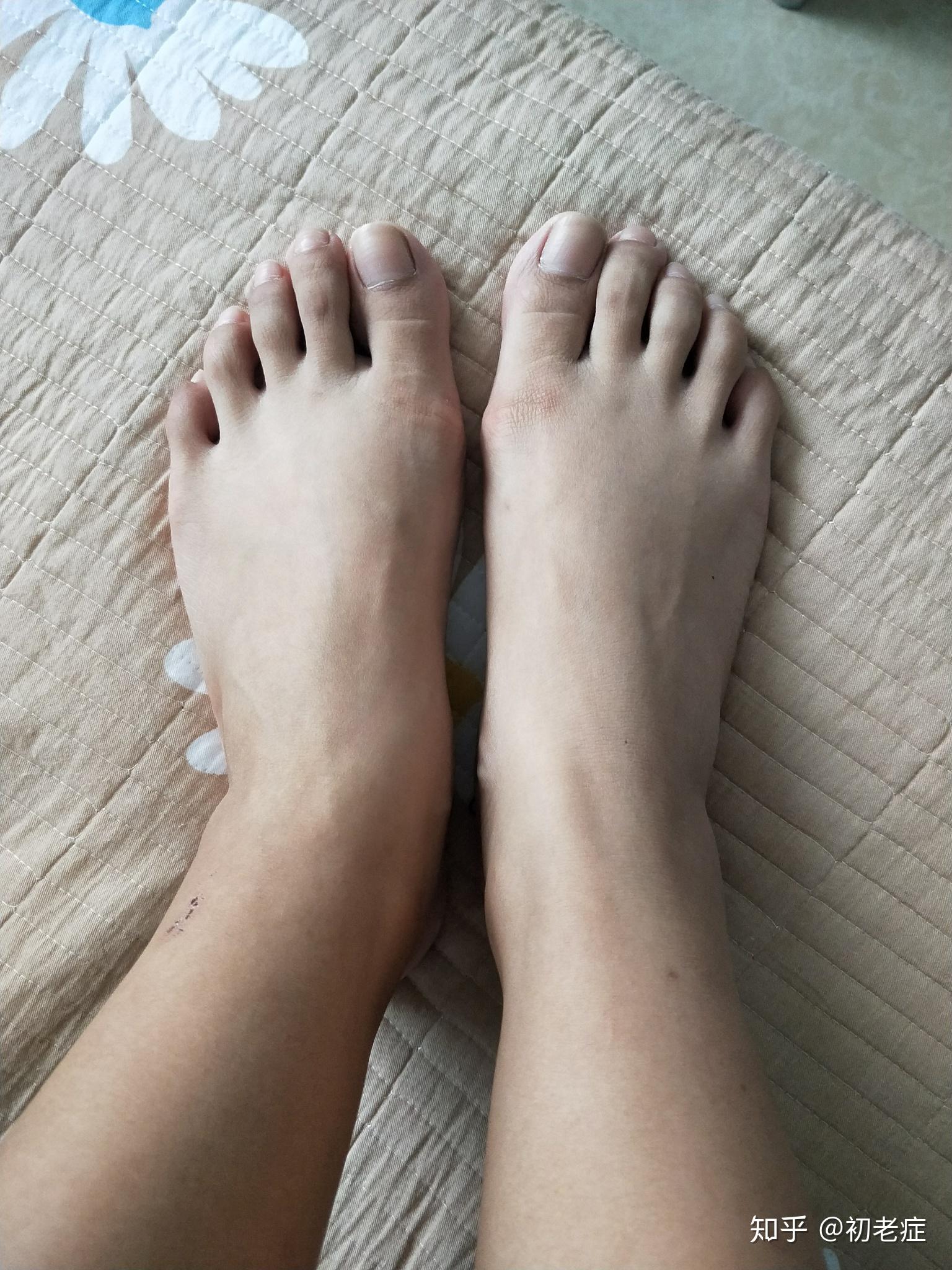 女生脚丑是种什么样的体验