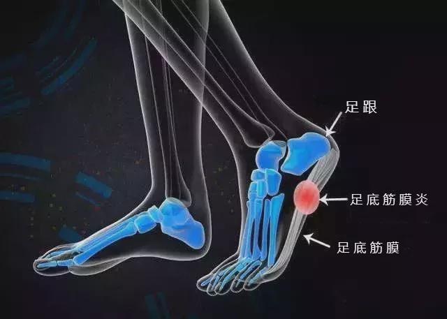 v2-0eaa66b82a22cd71204f60db190bfa44_1440w.jpg?source=172ae18b