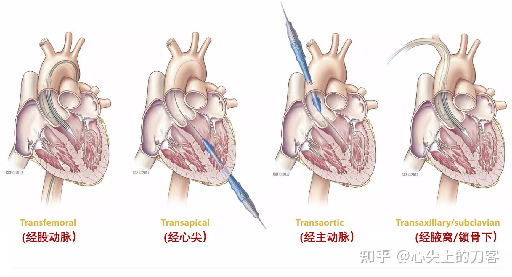 axillary artery图片