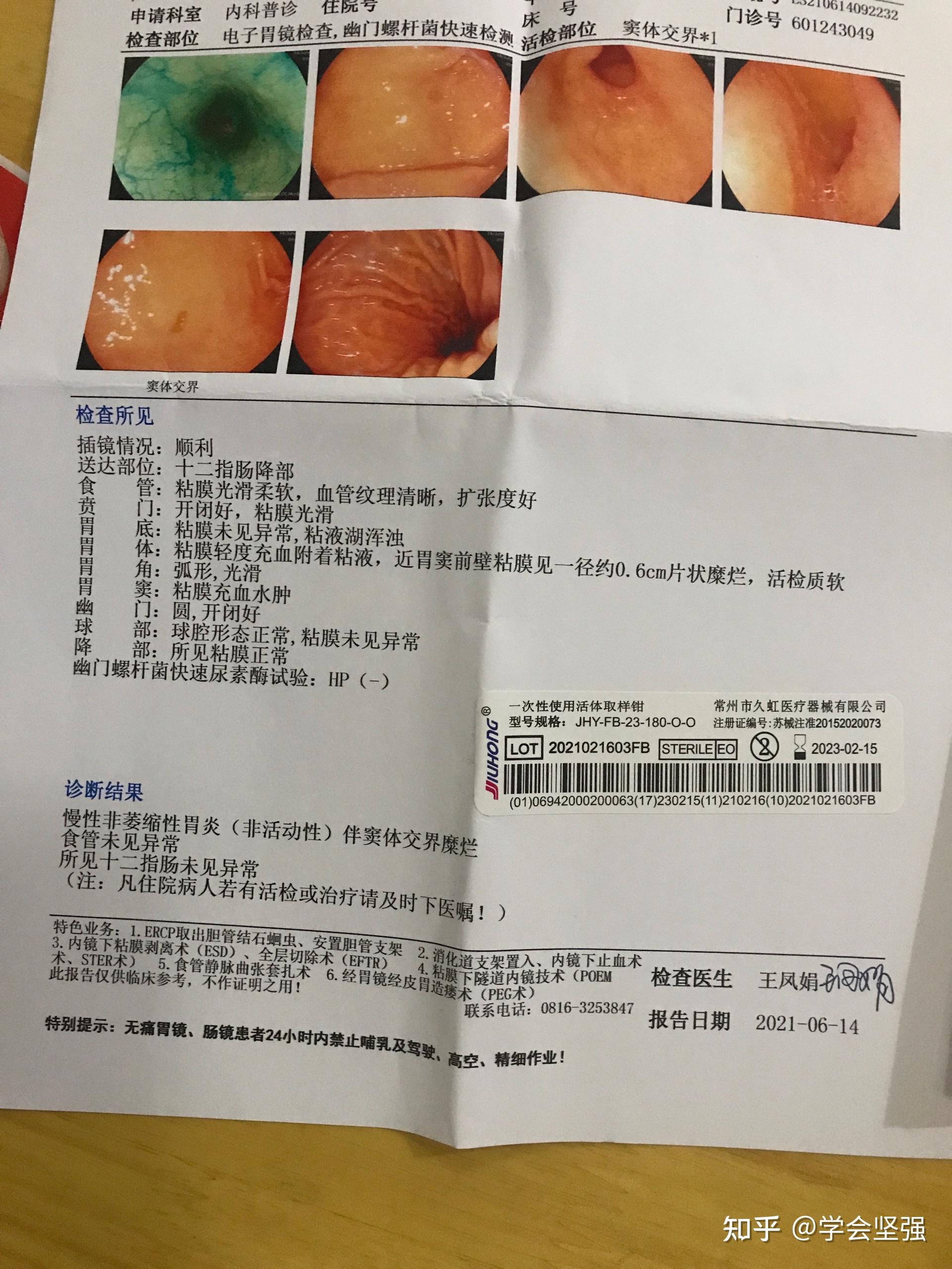 苏州胃镜单子图片图片