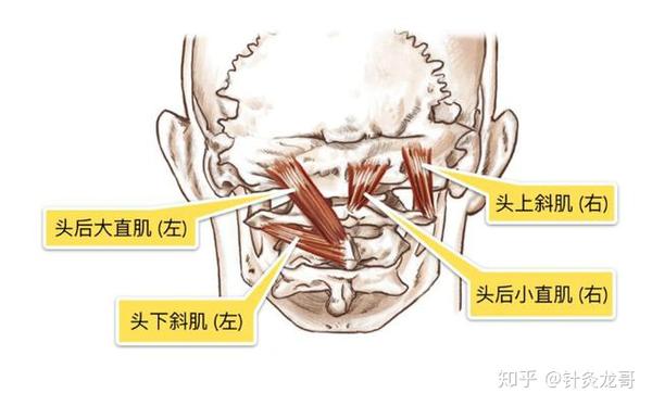 一大半颈椎疾病是由附着在下项线的肌肉引起 针灸按摩可解决 知乎