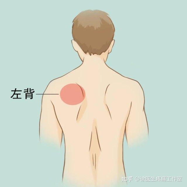 后背疼与多种病有关!一张「疼痛位置图解」看得明明白白 - 知乎