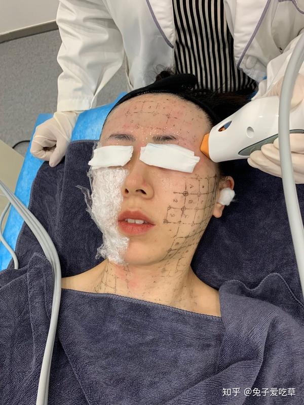 贵妇项目体验来了|我终于去做热玛吉啦!