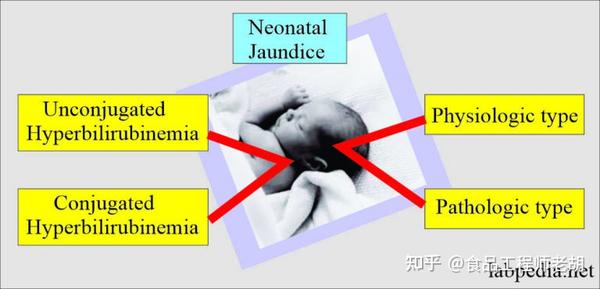 全面了解、科学应对新生儿黄疸,看这一篇就够了 - 知乎