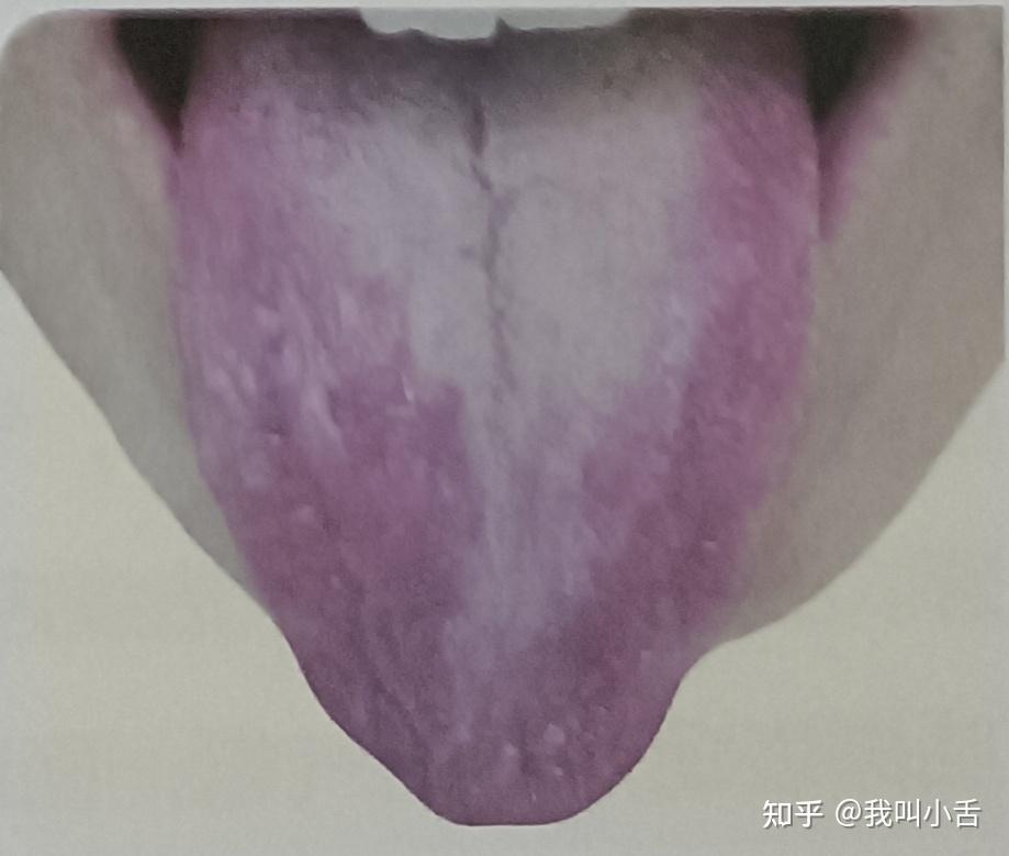 看看你的舌头长什么样?今天介绍的是吐弄舌~ - 知乎
