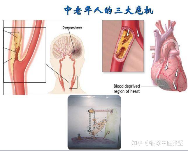 這是因為決定一個人壽命長短的,拋開意外身亡問題不說,主要是看有沒有