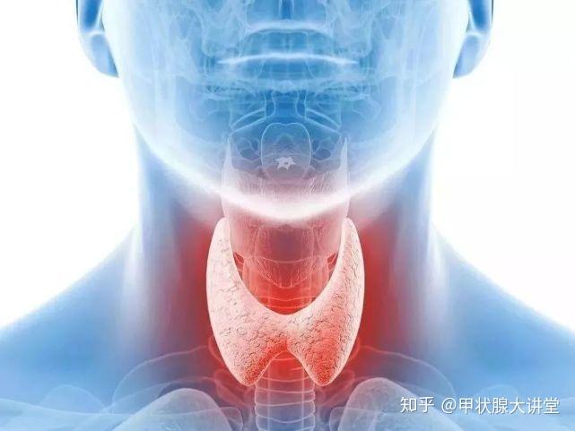 桥本氏甲状腺炎都有哪些常见的危害