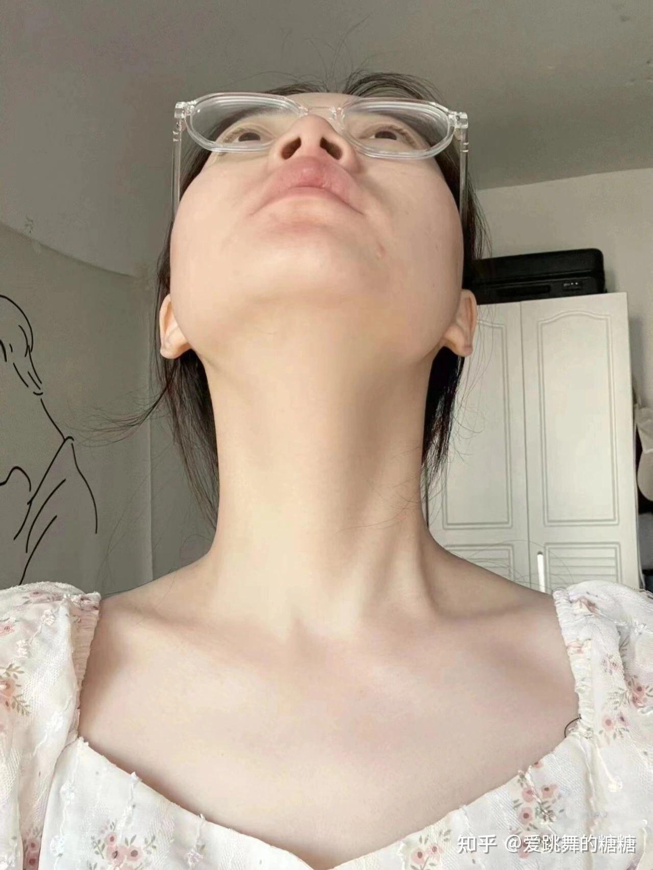 5, 最佳"天鹅颈"奖